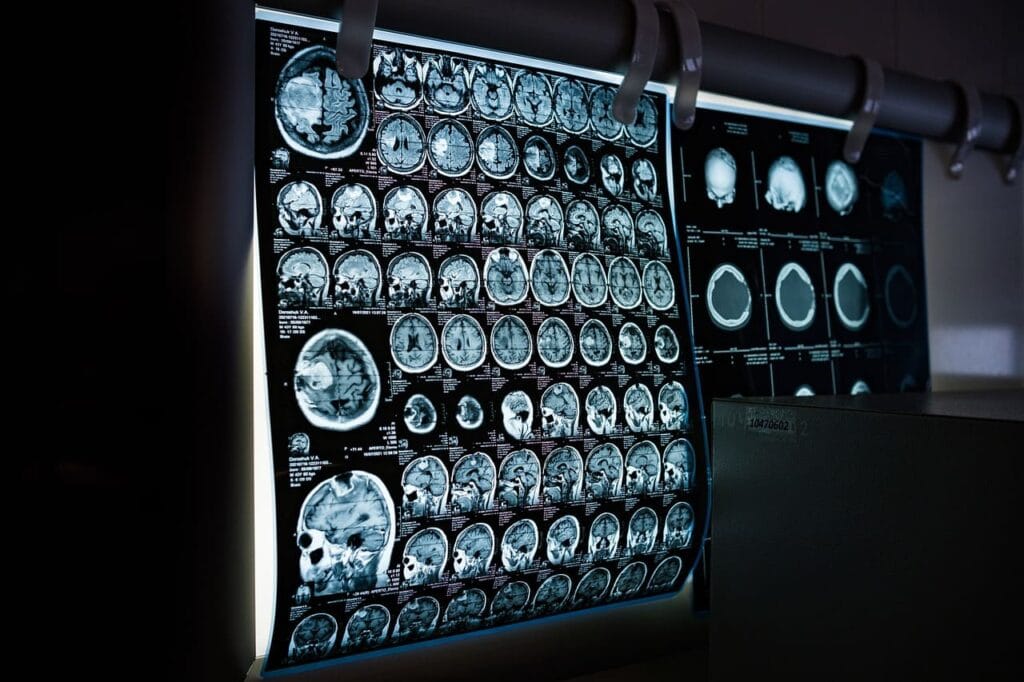 Image, scan of Human Brain unlocking new possibilities for research and treatment